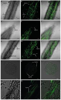 Verticillium dahliae-Arabidopsis Interaction Causes Changes in Gene Expression Profiles and Jasmonate Levels on Different Time Scales